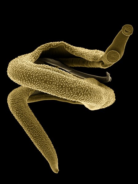 schistosomes